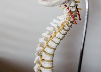 Spine model used to explain findings